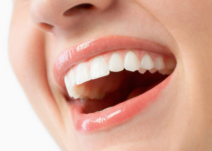 closeup of woman's teeth